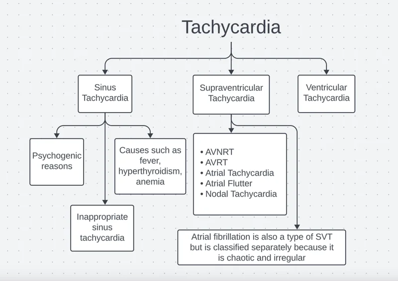 Types of tachycardia