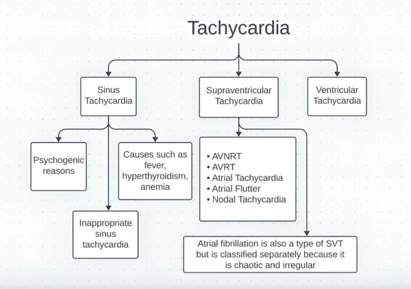 Types of tachycardia
