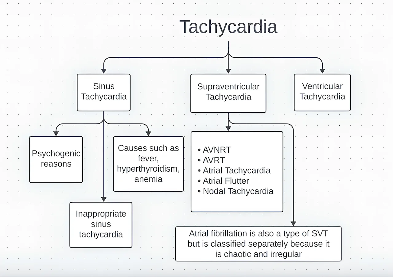 Types of tachycardia