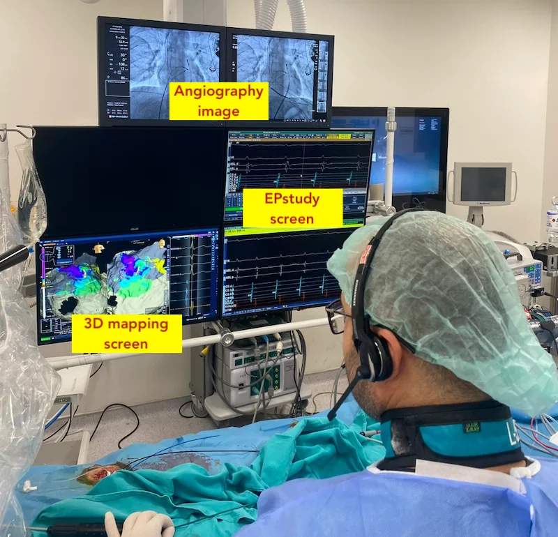 Cardiac Ablation