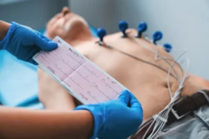 Electrocardiogram (ECG or EKG)