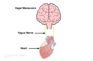 Vagal Maneuvers