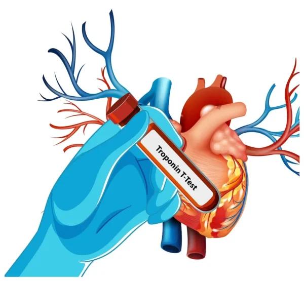Troponin test: what it is, and what high levels mean