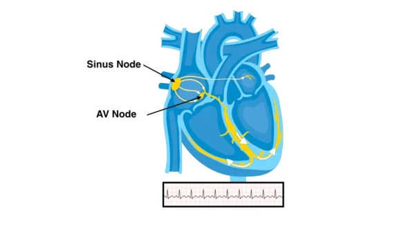 When Are Arrhythmias Dangerous