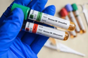 HOMA-IR Calculator – Insulin Resistance Test